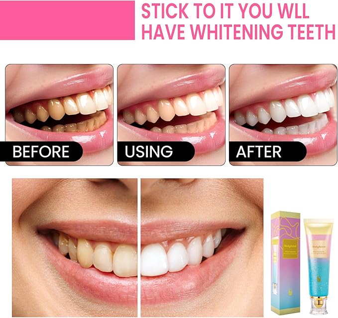 2 Pack BodyAccel Niacinamide Whitening Toothpaste, Triple Whitening Niacinamide Toothpaste, Brightens and Whitens Teeth, Natural Gentle, Fresh Breath