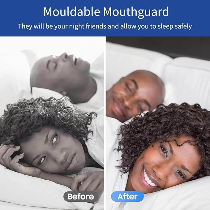 Mouth Guard for Clenching Teeth at Night, Night Guards for Teeth Grinding, Mouth Guard for Grinding Teeth at Night, Reusable Teeth Grinding Mouth Guard, Mouthguards for Grinding of Teeth (4 Piece Set)