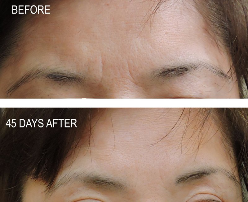 DNA Code® DIY 100% Argireline Peptides Solution Add to Your Own Cream
