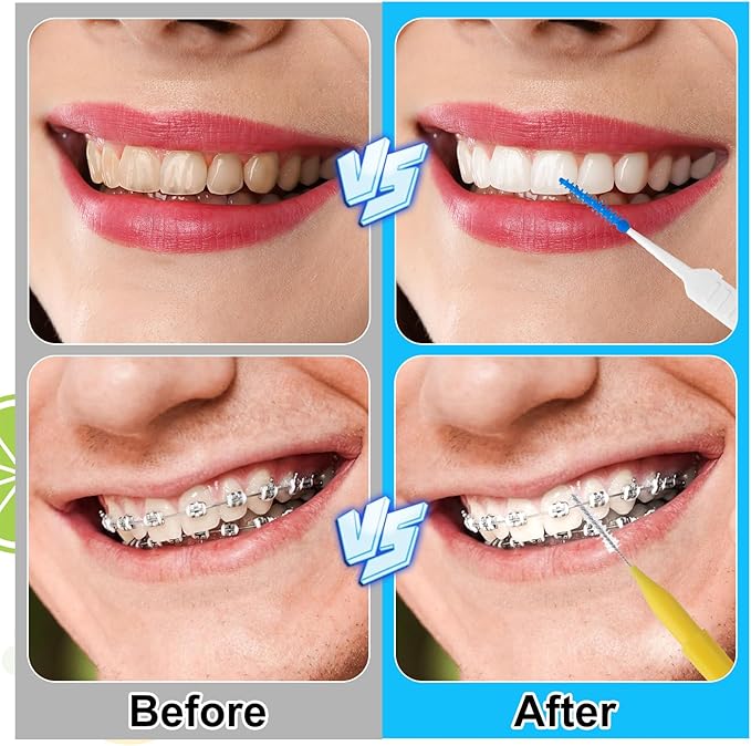 355 Pieces Braces Flossers for Braces, Interdental Brush Soft Dental Floss Picks Braces Cleaning Kit Toothpick Dental Brush Braces Teeth Flossers Brushes for Tooth Cleaner(Multiple Sizes)