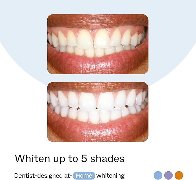Opalescence GO Home Advanced Teeth Whitening Trays 10% (4 Treatments) Hydrogen Peroxide PF - Whitening Prefilled Kit - Developed by Leaders in Professional Whitening - 6005-T