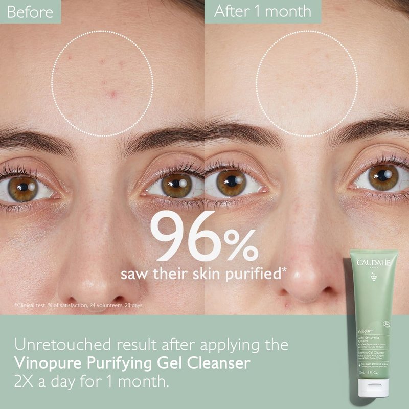 Caudalie Vinopure Pore Purifying Salicylic Acid Gel Cleanser - 150 mL
