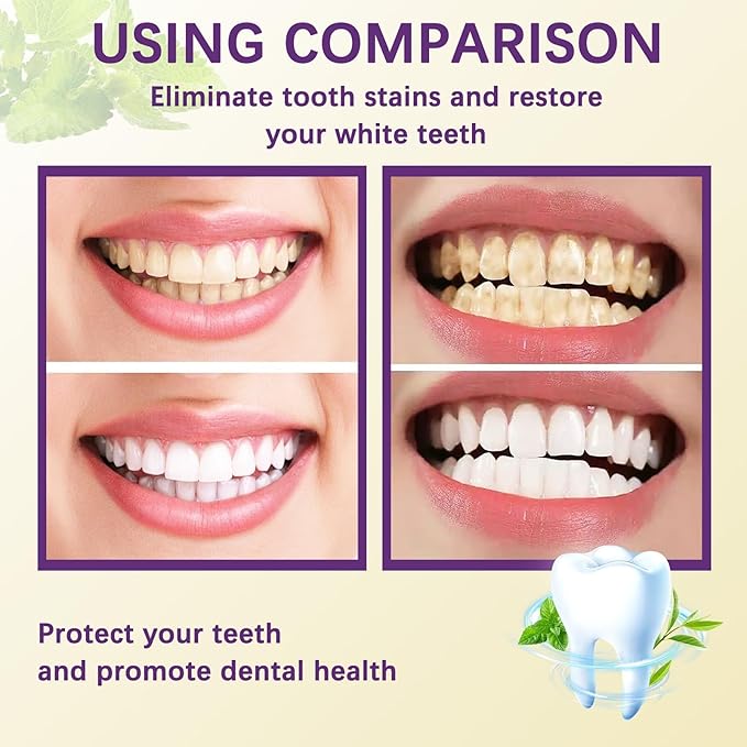 Tooth Refresh Toothpaste, Fresh Breath Whitening Toothpaste, Natural Oral Care & Enamel Repair, Helps Remove Coffee, Tea & Wine Stains, 3.52 oz Fresh Minty Gel, Pack of 2 (2)