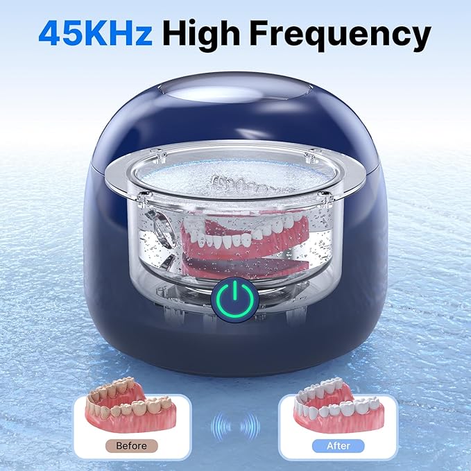 Ultrasonic Retainer Cleaner - UV Dental Cleaning Pod Night Guard Cleaner for Dentures, Aligner, Braces, Toothbrush Heads, Jewelry (Navy Blue)