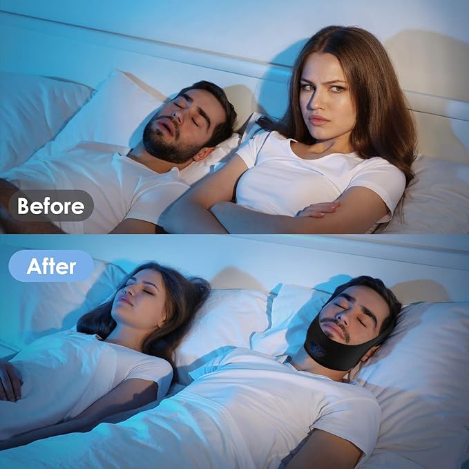 Chin Strap for Sleeping,Anti Snoring Chin Strap for CPAP Users,Don't Fade,Adjustable and Breathable Chin Strap-Keep Mouth Closed for Effectively Reduce Snoring,Skin-Friendly Comfortable Sleeping (1)