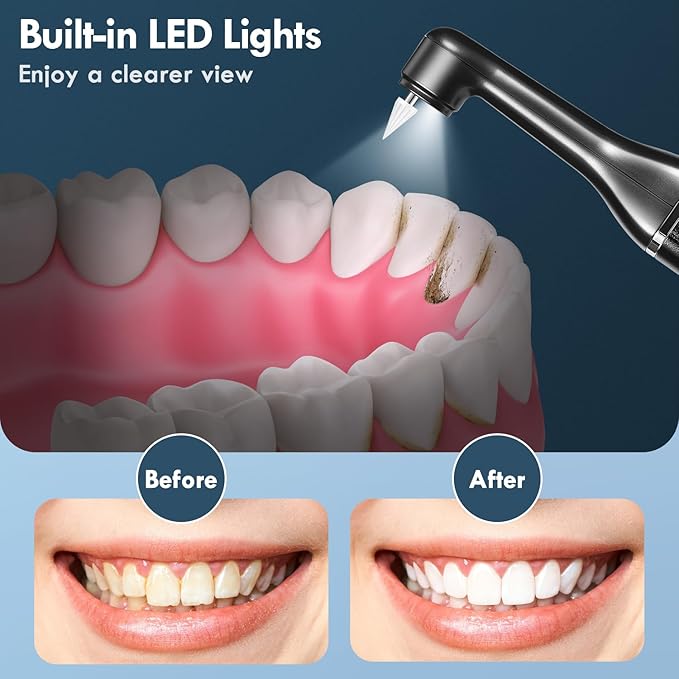 Tooth Polisher, Teeth Cleaning Kit with 5 Brush Heads, 3 Tooth Polish Paste, LED Light, IPX6, 5 Speed Modes, Rechargeable Professional Tooth Polishing Kit for Teeth Cleaning