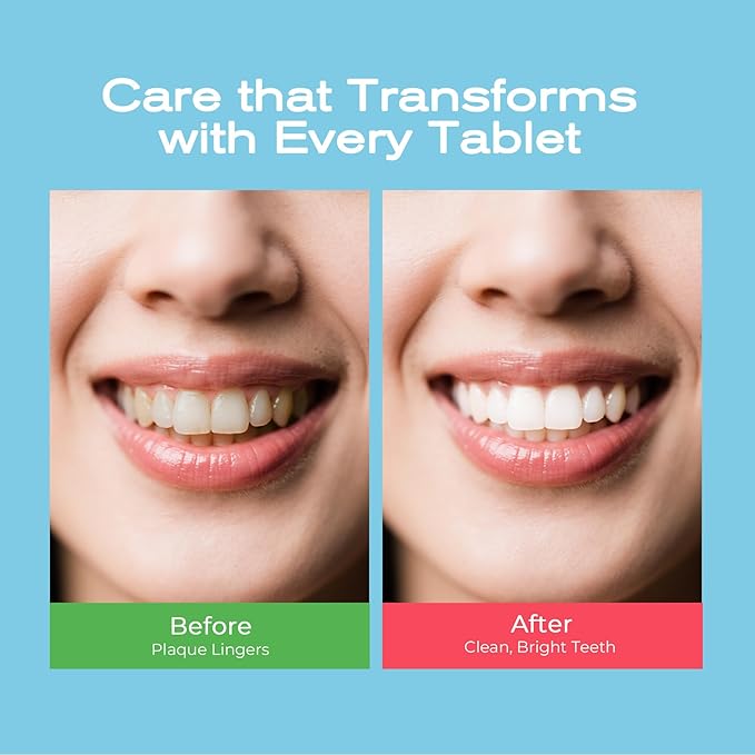 Auranexa Whitening Toothpaste Tablets – Remineralizing Nano Hydroxyapatite Chewable Toothpaste with Xylitol & Probiotics, Lime Mint + Watermelon Mint, Fluoride-Free, 2 Bottles (60 Tablets)