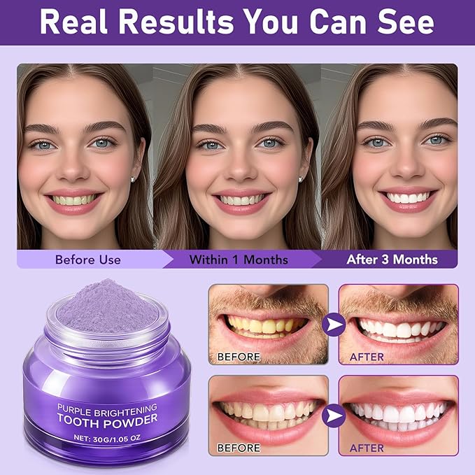 Teeth Whitening Powder,Purple Gentle Tooth Whitener,Safe & Gentle Formula,No Sensitivity,Daily Use, Enamel Friendly,Stain Removal, Color Corrector, and Toothpaste Booster (2)