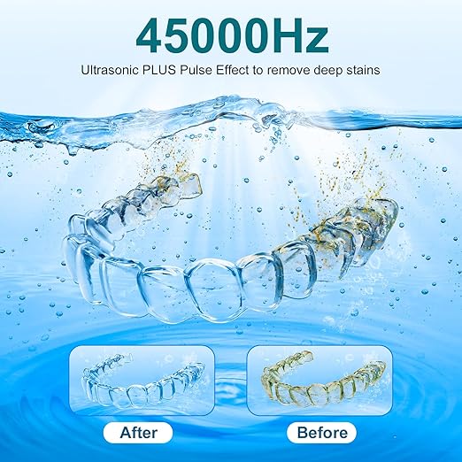 Ultrasonic Retainer Cleaner, Retainer Cleaner Machine Denture Cleaning Pod for Mouth Guards|Aligners|Braces|Toothbrush Heads|Jewelry, 45kHz with Digital Timer
