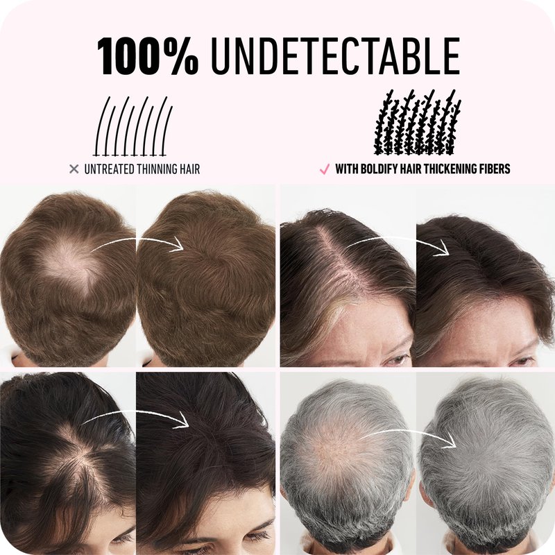 BOLDIFY Hair Fibers - Fill In Thinning and Fine Hair for an Instantly Fuller, Thicker Look - 14 Shades for Women & Men