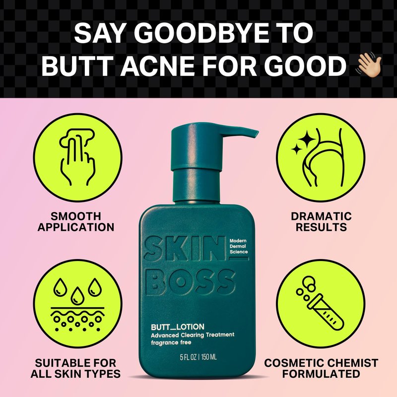 SKINBOSS 5oz Butt Acne Clearing Treatment - Body Acne Lotion for Pimples on Buttocks, Thighs, & Body, Targets Folliculitis, Scars, & Dark Spots, Hydrating Anti-Blemish Body & Self-Care Butt Cream