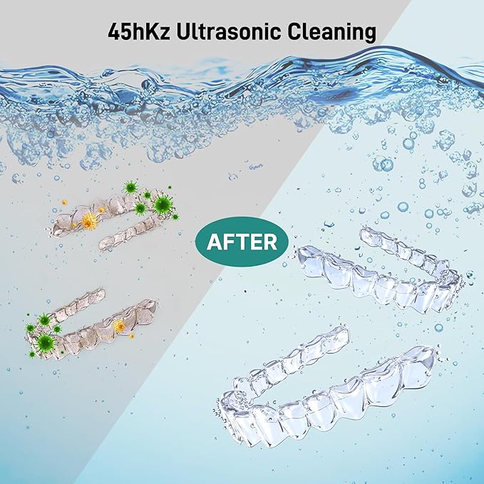 Ultrasonic Retainer Cleaner, Dental Cleaning Pod with U-V Lights, 45kHz Retainer Cleaner Machine for Dentures, Toothbrush Heads, Jewelry, Aligner, Night Mouth Guards (White)