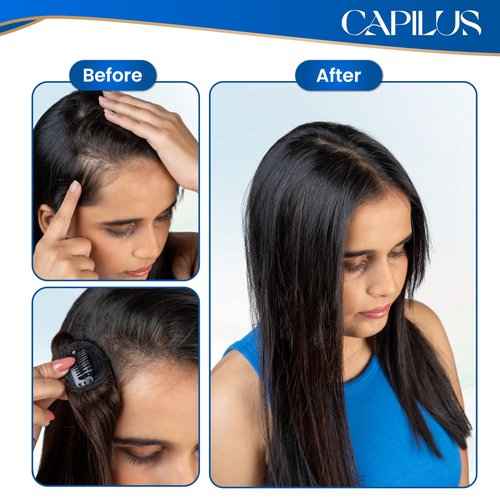 Capilus Invisible Hair Patch (Natural Brown, 12 Inch 1 Pack) | 100% Indian Human Hair Extensions for Women & Girls | Natural-Looking Volumizer | Undetectable, Durable & Non-Damaging Clip Mechanism