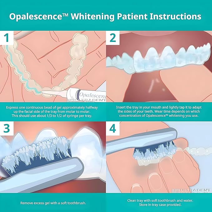 Opalescence 15% Gel Syringes Teeth Whitening Refill Kit - Low Sensivity (4 Syringes) - Cool Mint - Carbamide Peroxide - Made in The USA by Ultradent Tooth Whitening 5195-2