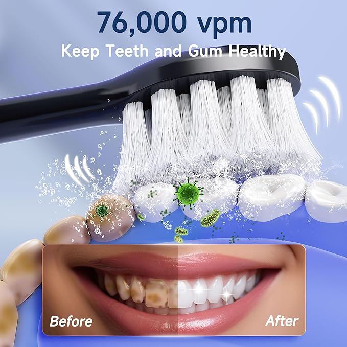 mornwell Sonic Electric Toothbrushes, Rechargeable Electric Toothbrush with 8 Brush Heads 76000 VPM Deep Clean 4 Modes, Travel Toothbrushes Fast Charge 4 Hours Last 45 Days for Adults and Kids