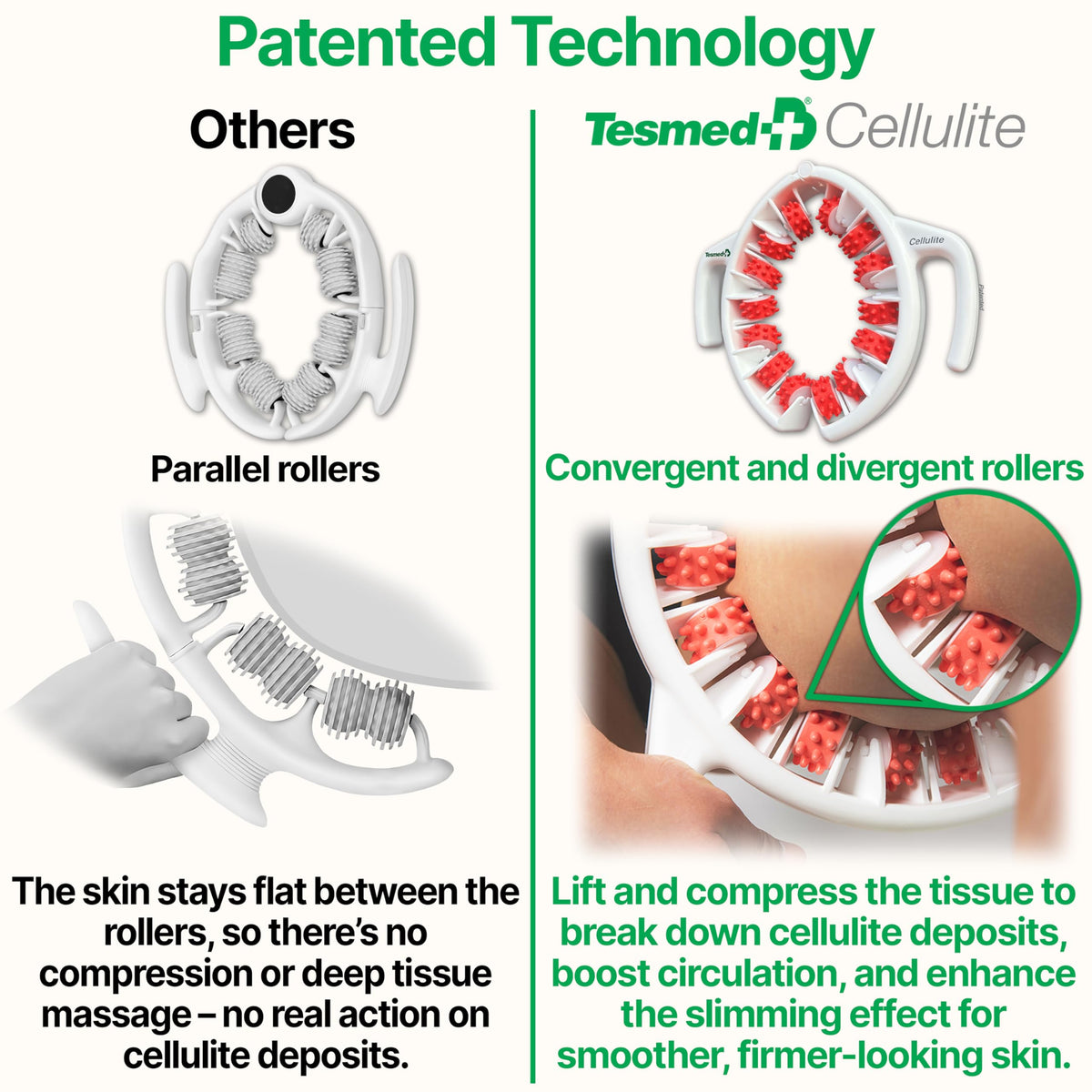 TESMED Cellulite Manual Massager : Made in Italy, Patented with Converging & Diverging Roller Technology. Anti Cellulite Roller for Thighs and Buttock