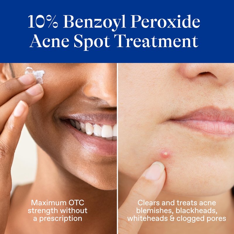 Differin Acne Spot Treatment with 10% Benzoyl Peroxide, Maximum Strength OTC Acne Treatment, Fast Acting Spot Treatment for Face, 1 oz