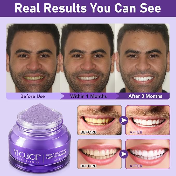 Teeth Whitening Powder, Teeth Whitening, Whitening Toothpaste Power, Removes Stains, No Sensitivity, Breath Freshener, Mint Flavor Purple Brightening Powder 30g