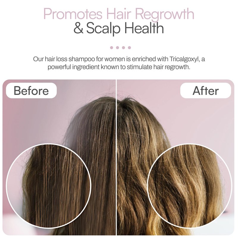Foltene Strengthening Shampoo for Women – Reduces Thinning, Boosts Volume, and Enhances Hair Health – Silicone & Sulfate-Free Hair Thickening Shampoo for Fuller Strands (6.76 fl. oz.)