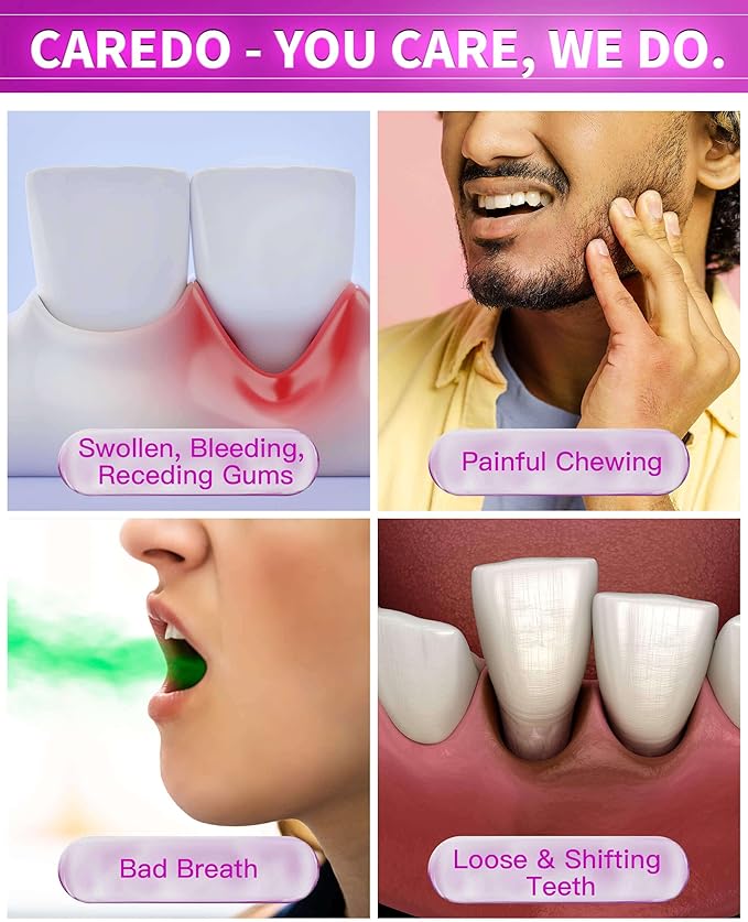Gum Toothpaste for Periodontitis, Gum Repair for Receding Gums, Gum Disease & Gingivitis Treatment, Periodontal Disease Treatment for Gum Health, Gum Disease Repair Bad Breath Toothpaste 3.52OZ