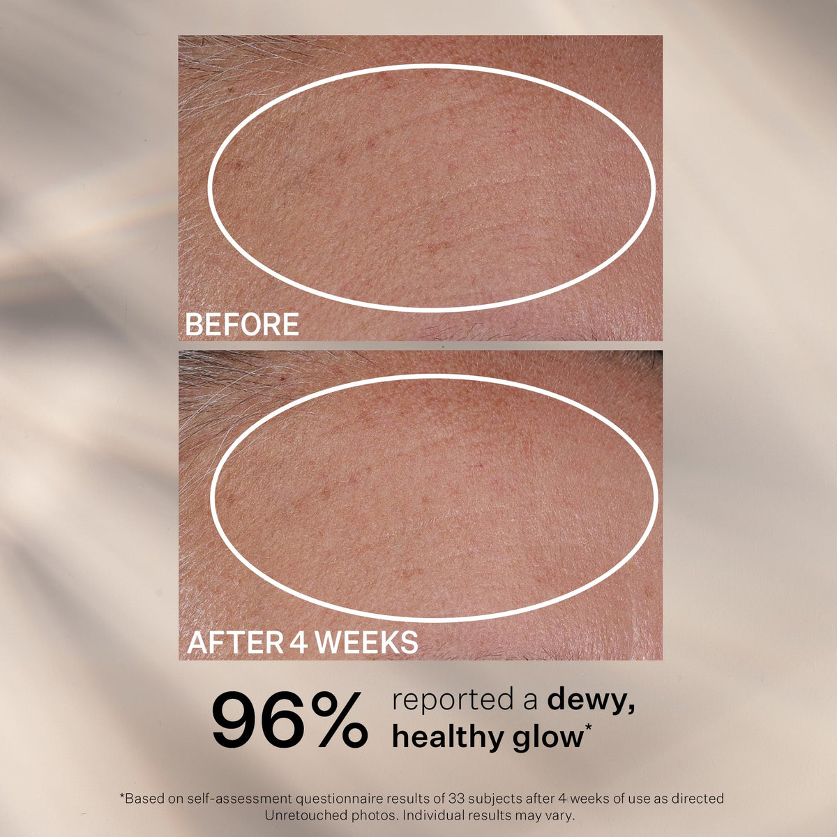 StriVectin Multi Action Hydration Multiplier Serum with Hyaluronic Acid, Ceramides and Peptides for Dehydrated, Dry Skin