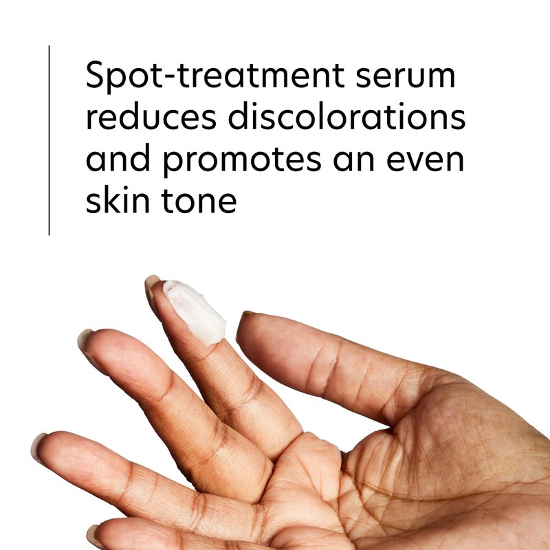 PCA SKIN Hydroquinone-Free Pigment Gel Dark Spot Corrector, Dark Spot Serum for Brightening Dark Spots and Hyperpigmentation, Helps Even Skin Tone and Promote a Clear Complexion, 1.0 oz Pump