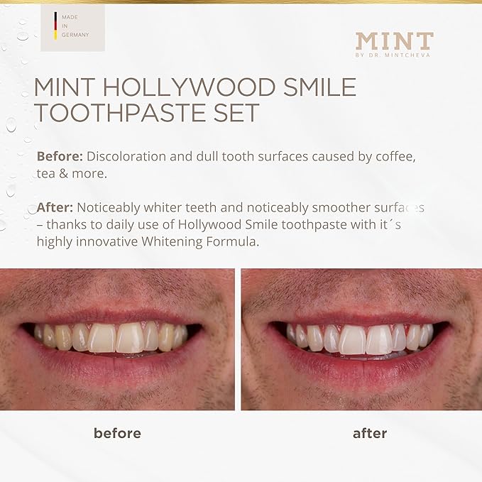 Mint Day & Night Toothpaste Set (2X 85ml) – with & Without Fluoride – MPT1 Ultra Polish Technology with Perlite – Natural Whitening, Gentle Low Abrasion, Vegan, Microplastic-Free, Mor
