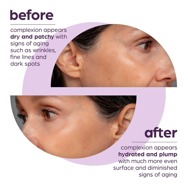 50% Beta Glucan Anti-Aging, Plumping Serum (1.01 Fl Oz (Pack of 2), 2pcs)