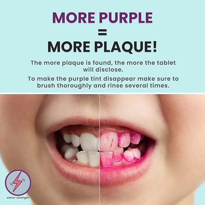 Plaque Disclosing Tablets for Teeth, 96 Count, Dental Disclosing Tablets for Kids or Adults, Shows Plaque, Helps Teach Kids Teeth-Brushing Habits for Clean Smile, by Fresh Knight, (Pack of 1)
