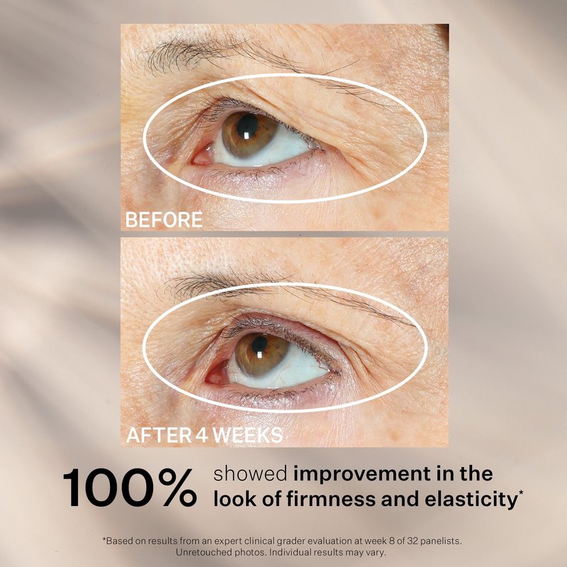 StriVectin Tighten and Lift Peptight 360 Degree Eye Serum with Tightening and Brightening Peptides for Wrinkles, Under Eye Bags and Puffiness, 1 fl. Oz