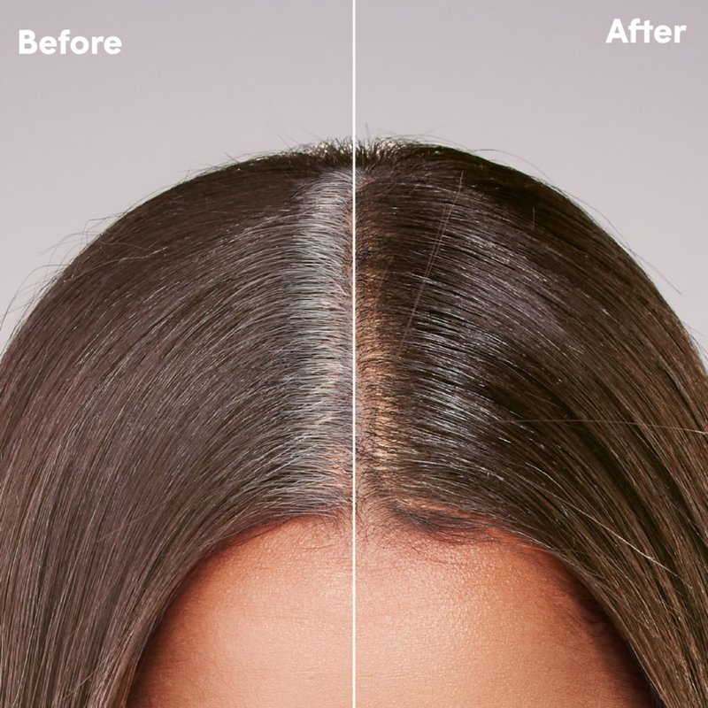 dpHUE Root Touch-Up Kit for Resistant Grays, Light Brown - Permanently Cover Difficult, Stubborn Gray Hair - 2 Applications Included - Vegan & Leaping Bunny Certified