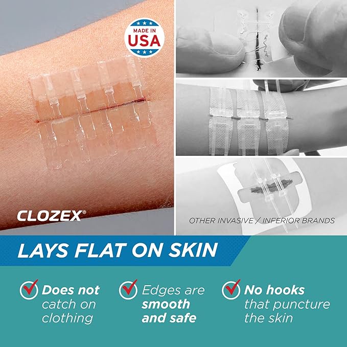 Clozex Pediatric Laceration Closures - Repair Wounds Without Stitches, FSA HSA Eligible Skin Closure Device for 3 Individual Wounds Or Combine for Total Length of 2 3/8 Inches