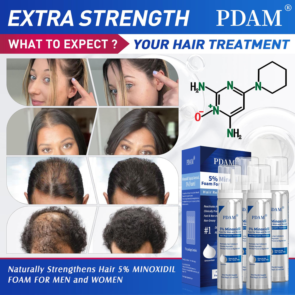 Minoxidil for Men and Women Foam Hair Growth - 5% Minoxidil Foam Hair Regrowth Treatment for Men, Topical Hair Loss Treatments, Extra Strength Thicker & Fuller Hair, 4 x 2.11 oz for 4 Months