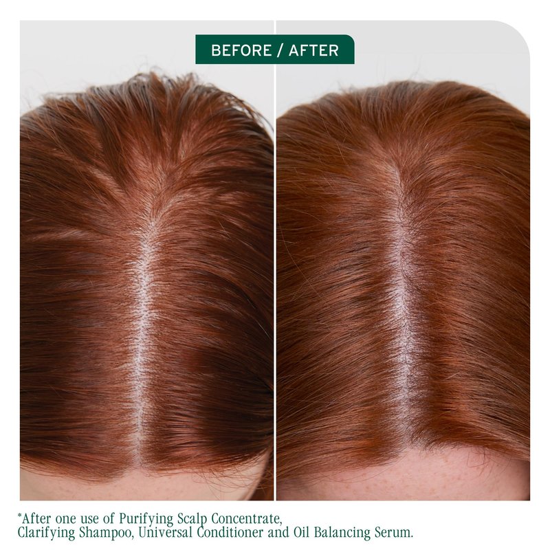 Biolage Scalp Sync Clarifying Shampoo - Residue & Buildup Remover, For Oily Scalp, Fermented Tea & Glycolic Acid, Vegan & Paraben-Free