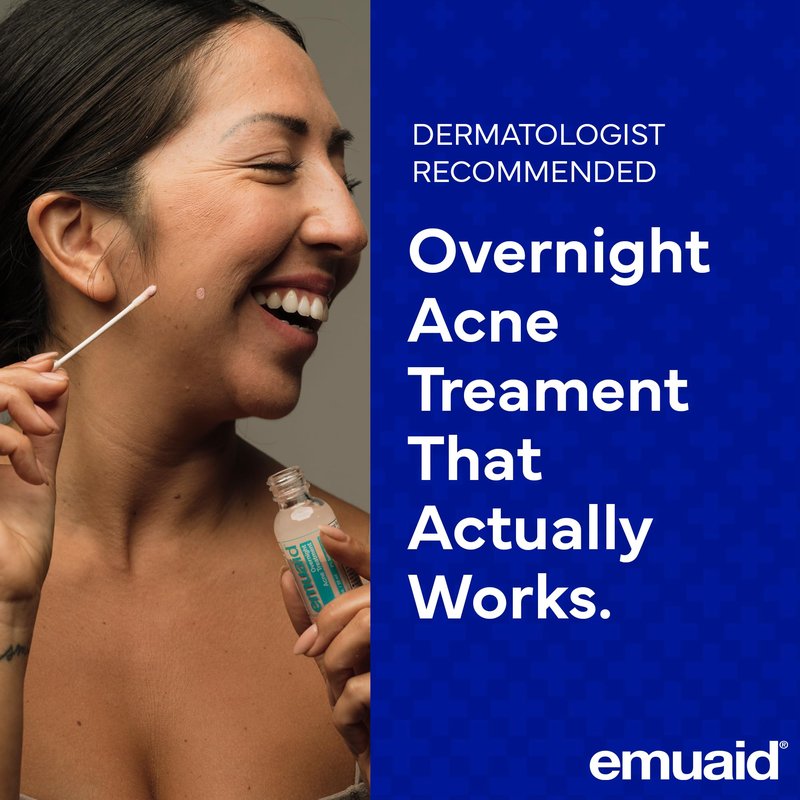 EMUAID Overnight Acne Treatment, Gentle Fast-Acting Solution with Salicylic Acid for Adults and Teens, Clears Stubborn Pimples, Cystic Acne, Blackheads, Rosacea, and Hormonal Breakouts, 1oz
