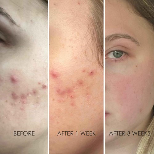 REFLEKT 3 Power Peptide Sculpting Face Cream