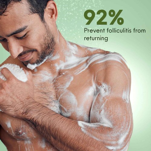 ABERA Folliculitis, BHA Shower Gel, High-Performance Folliculitis Body Wash, Wild Bitter Melon Extract, Reduces Back Acne & Hyperkeratosis, 2 Boxes + Gift Titanium Armpit Serum Roller