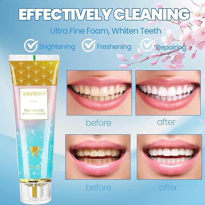 Niacinamide Whitening Toothpaste, YAYASHI Niacinamide Intensive Whitening Toothpaste with Natural Gentle Care Deep Stain Removal Cherry Blossom Mint Flavor, Improves Gum Health
