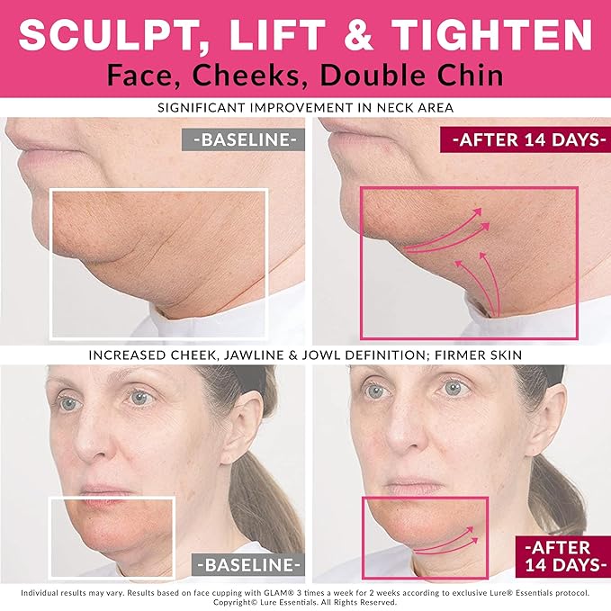 Lure Essentials Glam Facial Cupping Set (5 pc) Face Eyes Lips Cupping Set with Brush Collagen Lymphatic Massage