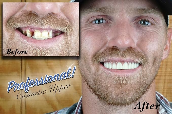 Professional Cosmetic Upper - New from Instant Smile! Hand Crafted Detail, Custom fit at Home! Works Best in Medium to Large Sized Mouths.