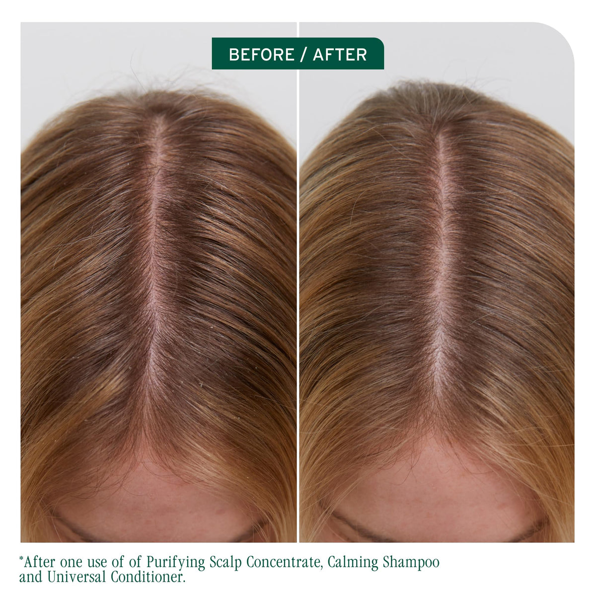 Biolage Scalp Sync Calming Shampoo and Universal Conditioner Set - Gently Cleanses Dry & Sensitive Scalps, Hydrates & Soothes, Fermented Tea Blend & Glycolic Acid, Vegan & Paraben-Free