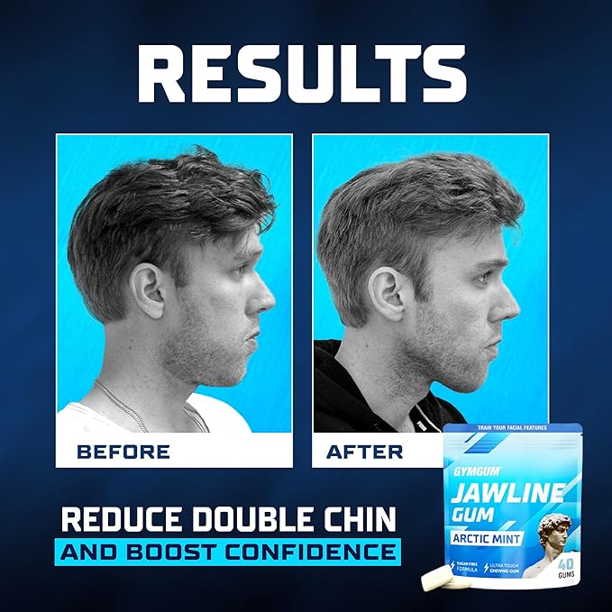 Gymgum Jawline Gum | Hard Chewing Gum For Jaw Strength | Train Your Facial Features - Mewing Jaw Gum | Ultimate Jawline Exerciser | 0 Calories & Sugar Free Hard Gum (Arctic Mint, 40 Count)
