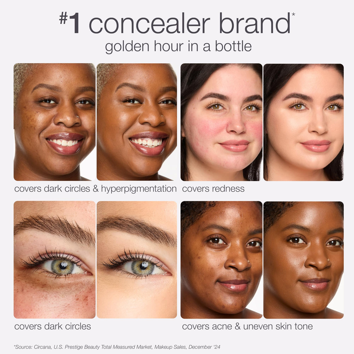 tarte shape tape radiant concealer – Medium-Coverage, Hydrating Finish Under Eye Concealer for Dark Circles, Redness & Discoloration, Vegan, Cruelty-Free, travel size, 35H medium honey