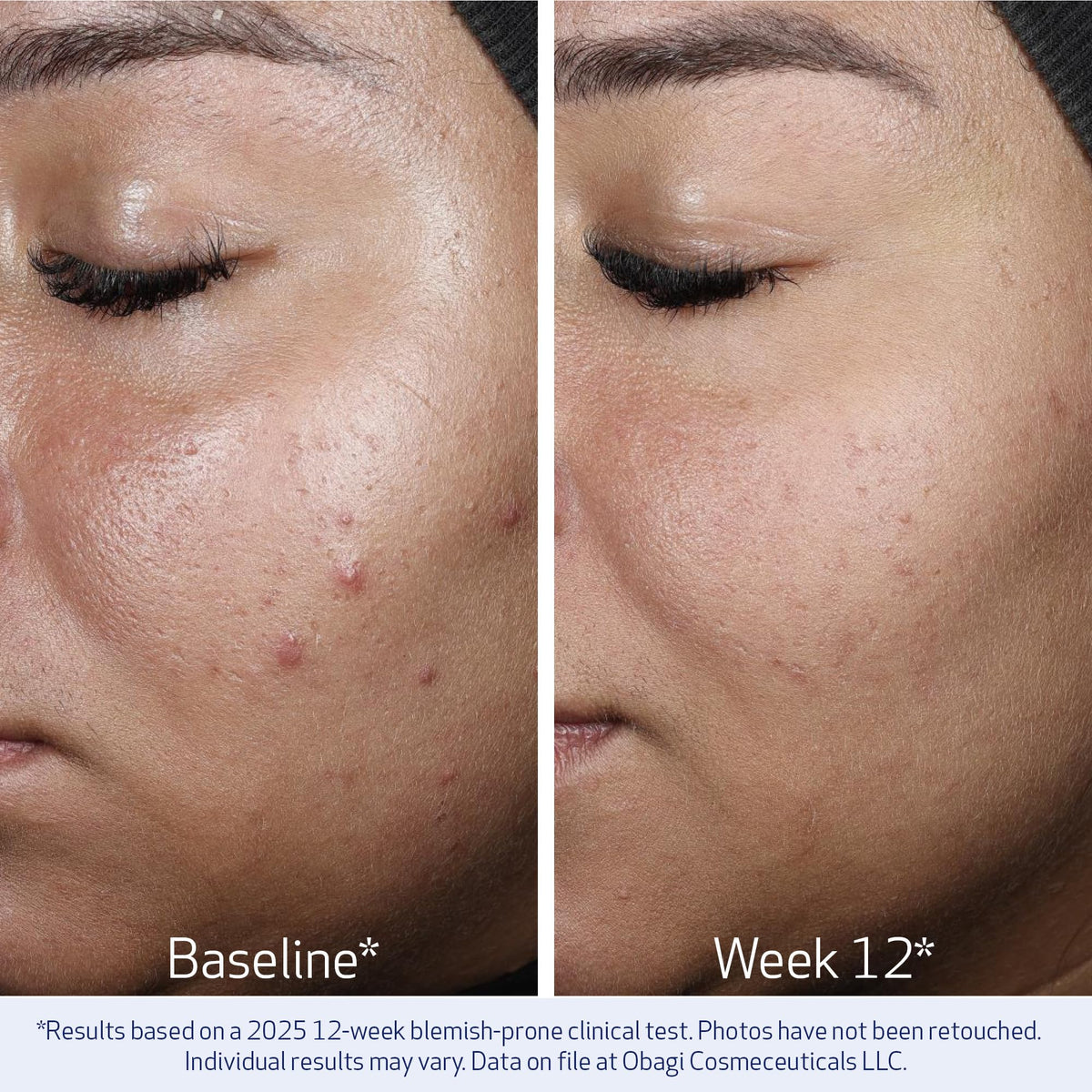 Obagi NU-GEN NAD+ Cellular Renewal Face Serum with Niacinamide & NMN – 1 oz
