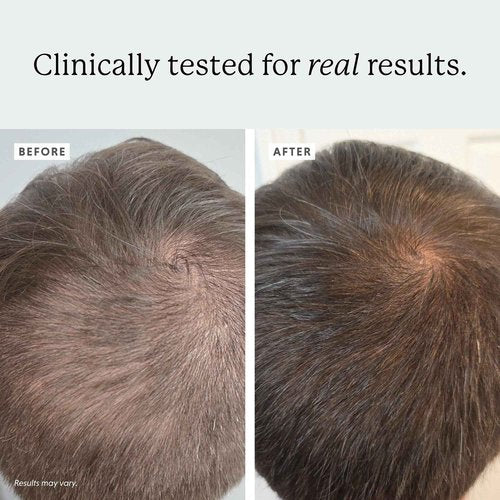 Colorsmith Densifying Scalp Serum, 1 fl oz, with Procapil and Redensyl