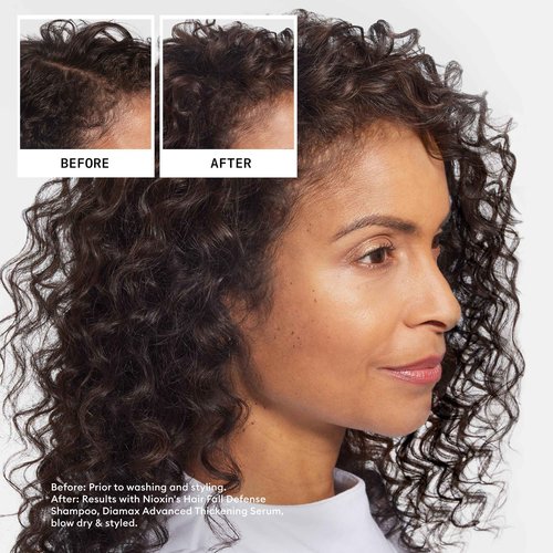 Nioxin Hair Fall Defense Shampoo | Activates Hair Follicles for Visibly Less Hair Loss | 8.1 Fl Oz + Nioxin Hair Fall Defense Intensive Daily Leave-In Hair Treatment | 2.3 Fl oz.