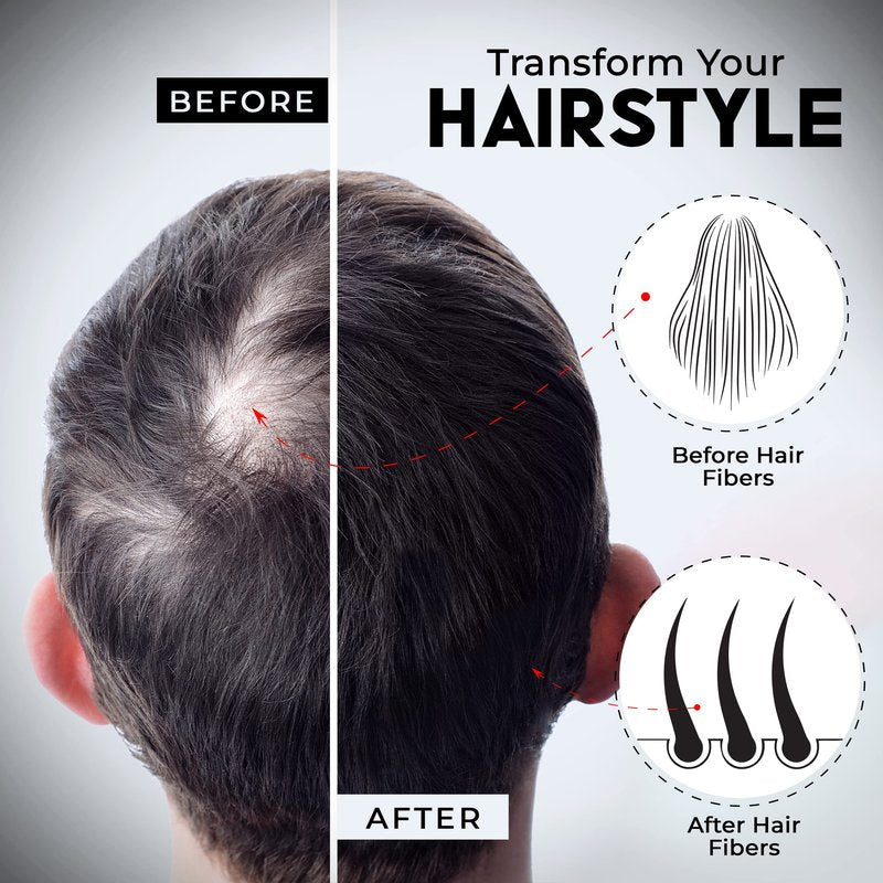 ELEVATE Hair Perfecting 2-in-1 Kit | Set Includes Natural Hair Thickening Fibers & Spray Applicator Pump Nozzle | Instantly Conceal & Thicken Thinning Balding Areas in Seconds Men & Women (Black)