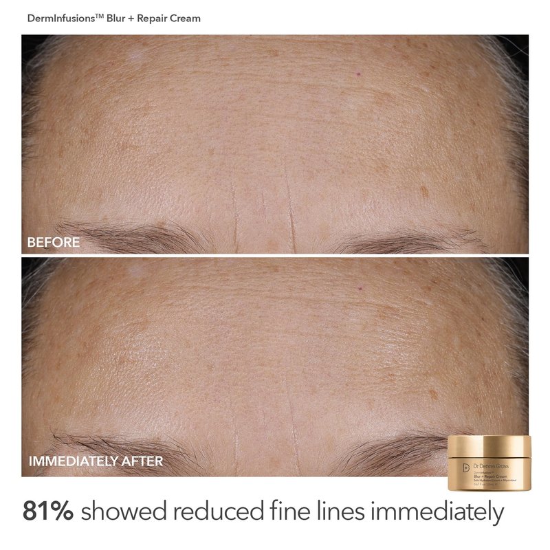 Dr Dennis Gross Plump & Smooth Limited Edition Kit – DermInfusions™ Blur + Repair Cream (0.67 oz) + 5 Alpha Beta® Universal Daily Peels | $50 Value